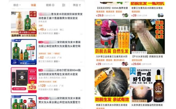 脱发植发的市场现状