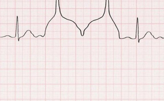 520品牌借势文案赏析