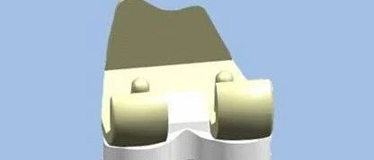 精细化运营的考量是什么？